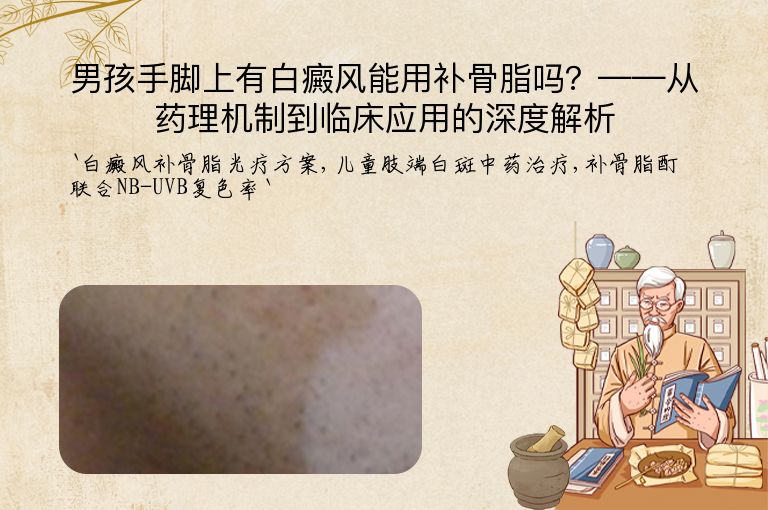 男孩手脚上有白癜风能用补骨脂吗？——从药理机制到临床应用的深度解析