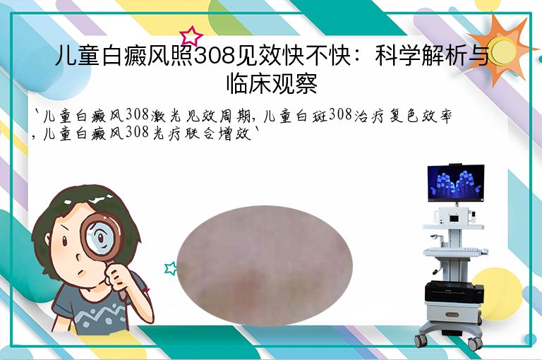 儿童白癜风照308见效快不快:科学解析与临床观察