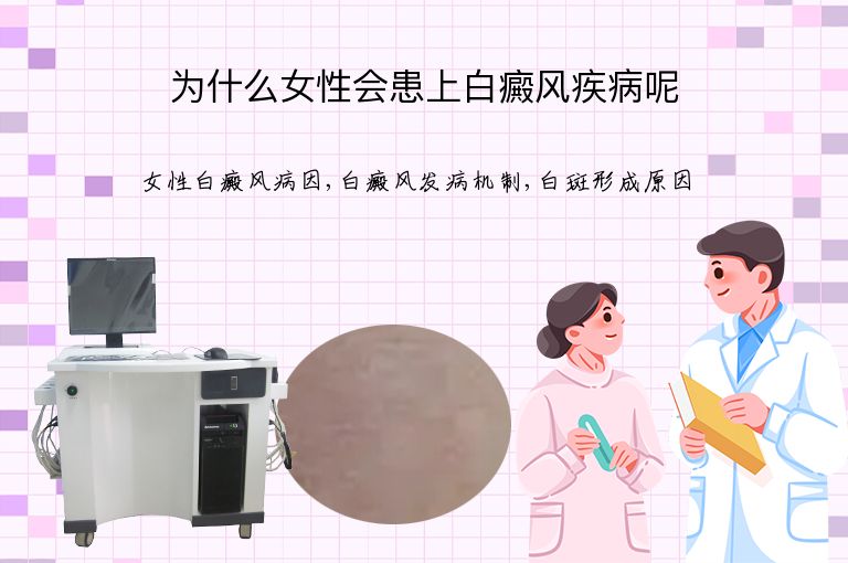 为什么女性会患上白癜风疾病呢”