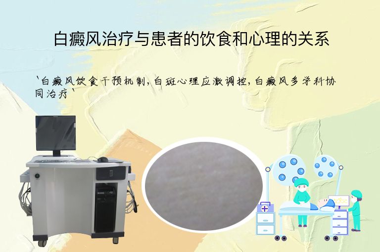 白癜风治疗与患者的饮食和心理的关系”