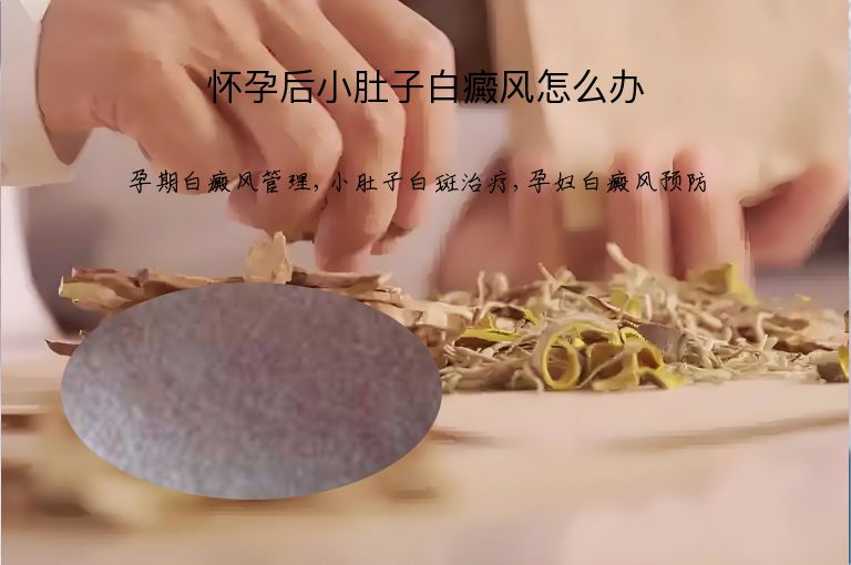 怀孕后小肚子白癜风怎么办”