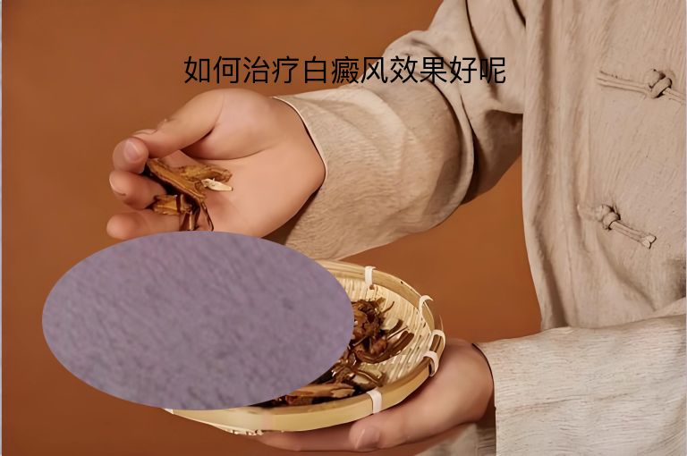 如何治疗白癜风效果好呢”