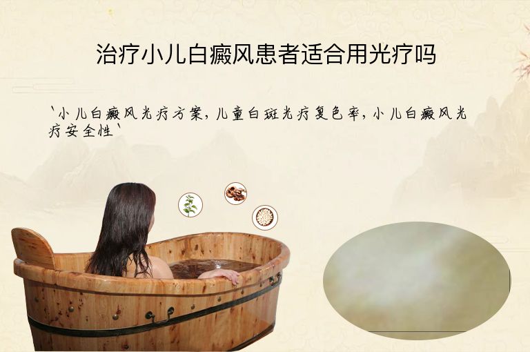 治疗小儿白癜风患者适合用光疗吗