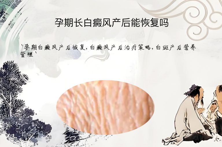 孕期长白癜风产后能恢复吗”