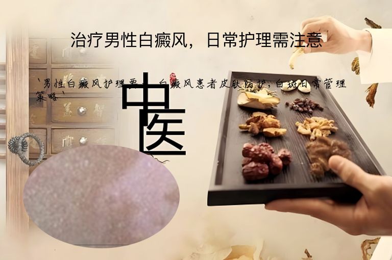 治疗男性白癜风,日常护理需注意