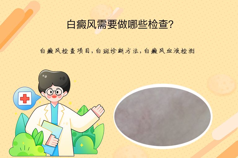 白癜风需要做哪些检查?”