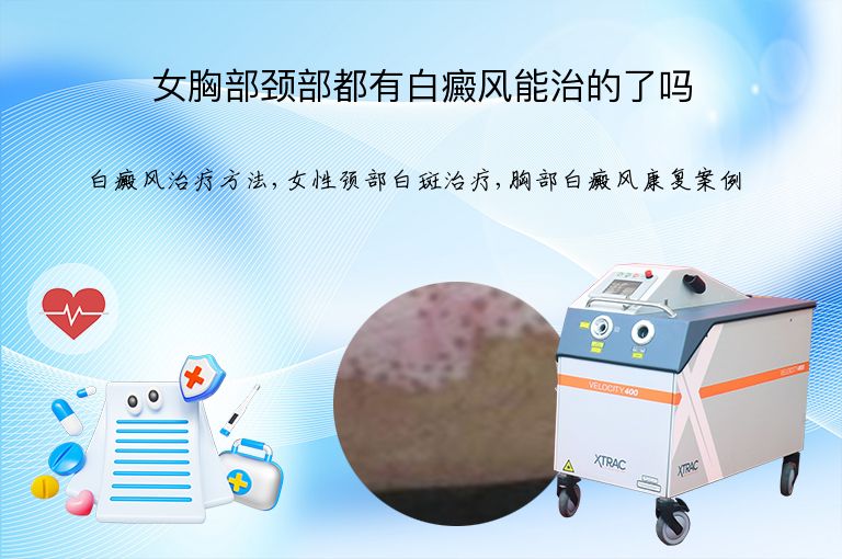 女胸部颈部都有白癜风能治的了吗”