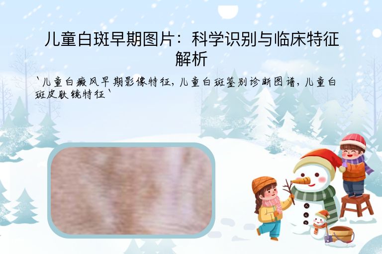 儿童白斑早期图片:科学识别与临床特征解析