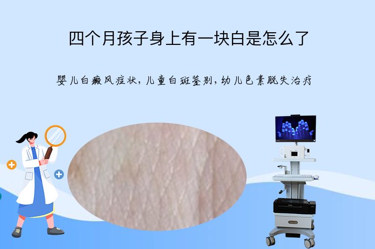 四个月孩子身上有一块白是怎么了”