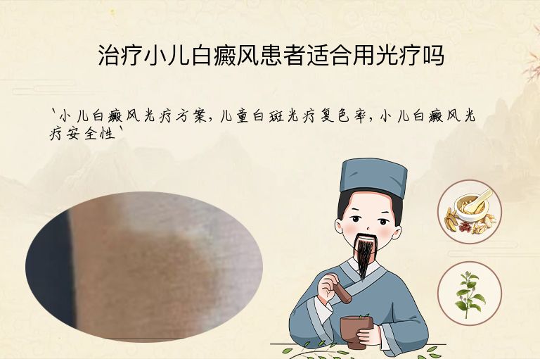 治疗小儿白癜风患者适合用光疗吗