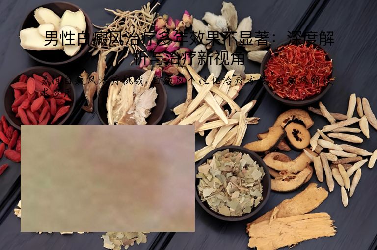 男性白癜风治疗多年效果不显著:深度解析与治疗新视角”