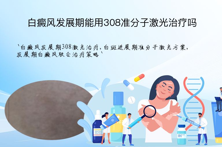 白癜风发展期能用308准分子激光治疗吗”
