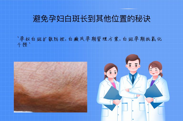 避免孕妇白斑长到其他位置的秘诀
