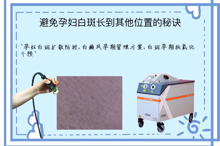 避免孕妇白斑长到其他位置的秘诀