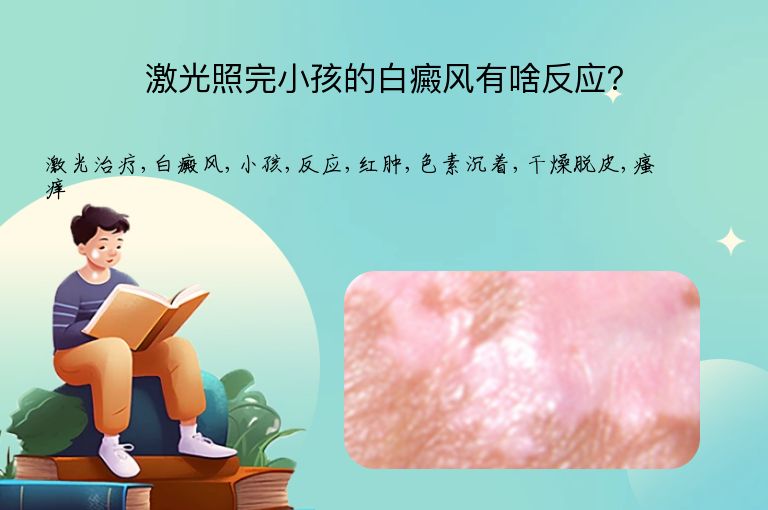 激光照完小孩的白癜风有啥反应?”