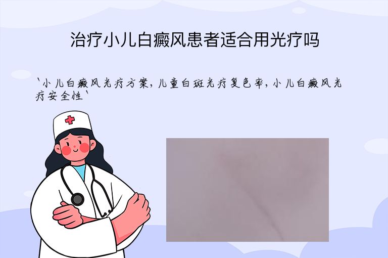 治疗小儿白癜风患者适合用光疗吗