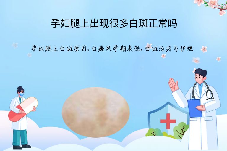 https://www.bdfsjzyy.com/d/file/p/d401ed50221e2b13e0804f72f82fbcf9.jpeg