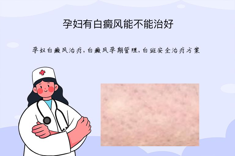 孕妇有白癜风能不能治好”