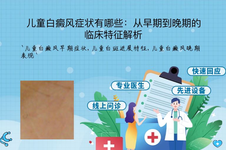 儿童白癜风症状有哪些:从早期到晚期的临床特征解析