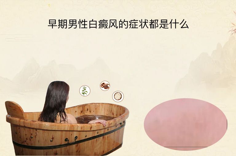 https://www.bdfsjzyy.com/d/file/p/ecb689f406ad2ceaff61efdc7429ea13.jpeg