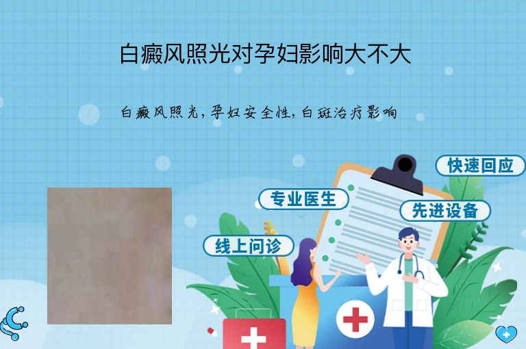 白癜风照光对孕妇影响大不大”