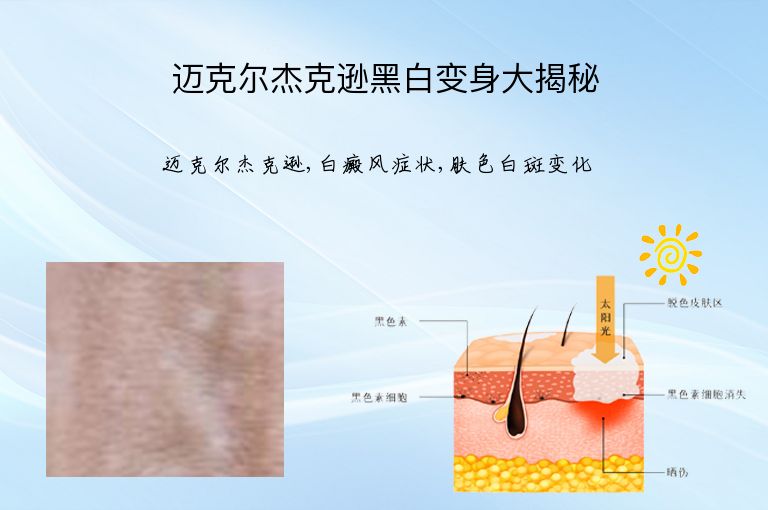 迈克尔杰克逊黑白变身大揭秘”