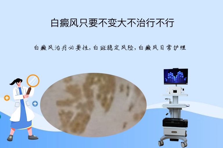 白癜风只要不变大不治行不行”
