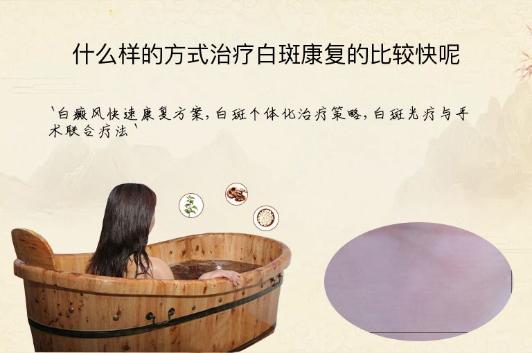 什么样的方式治疗白斑康复的比较快呢