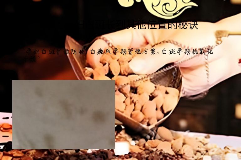 避免孕妇白斑长到其他位置的秘诀