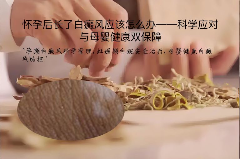 怀孕后长了白癜风应该怎么办——科学应对与母婴健康双保障”
