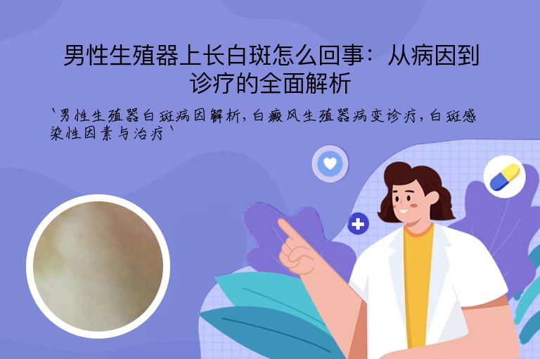 男性生殖器上长白斑怎么回事:从病因到诊疗的全面解析