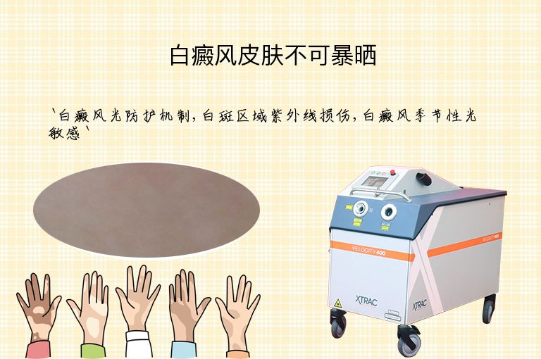 白癜风皮肤不可暴晒