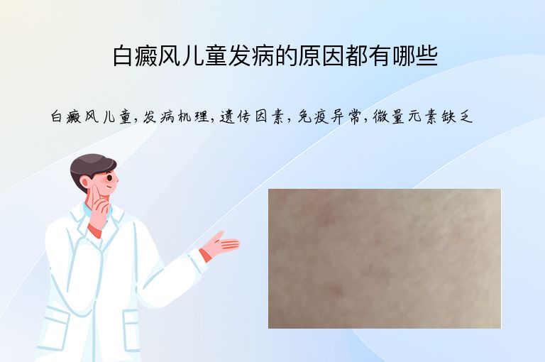 白癜风儿童发病的原因都有哪些”