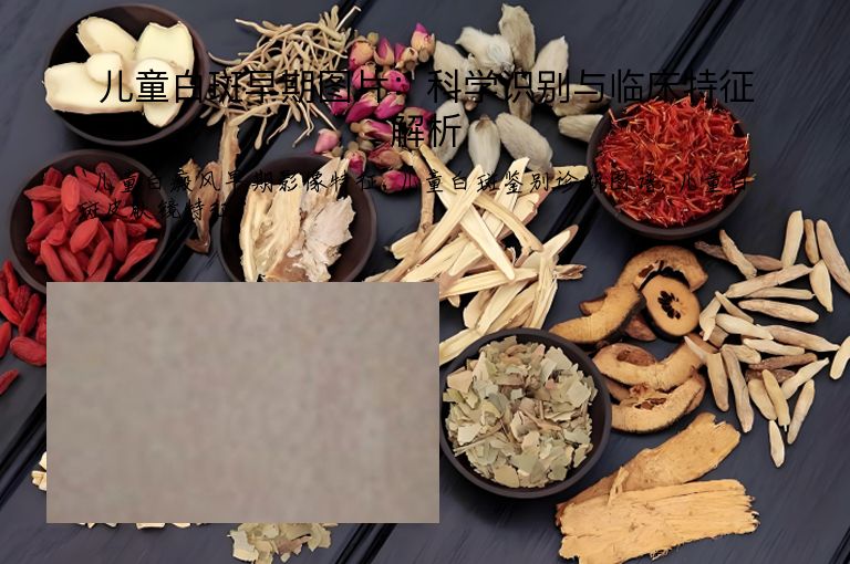 儿童白斑早期图片：科学识别与临床特征解析