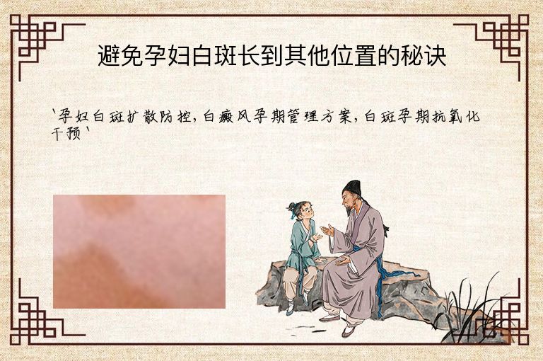 避免孕妇白斑长到其他位置的秘诀