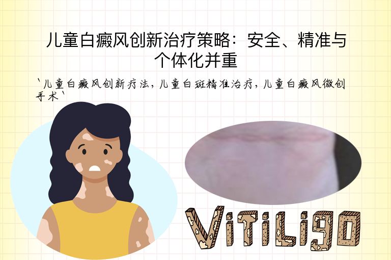 儿童白癜风创新治疗策略：安全、精准与个体化并重