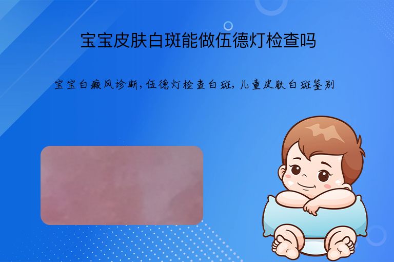 https://www.bdfsjzyy.com/d/file/p/3274a5b560113e66bc9942f1b534be97.jpeg