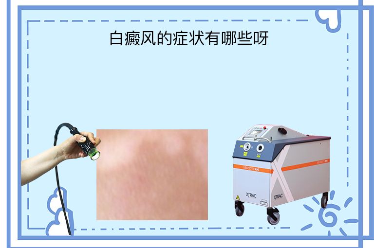 https://www.bdfsjzyy.com/d/file/p/ba8cdd257d628028929cbc3a9ce8c13b.jpeg