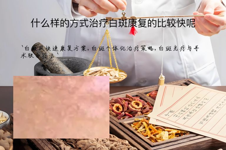 什么样的方式治疗白斑康复的比较快呢
