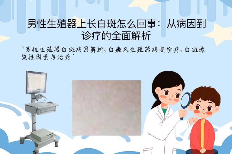 男性生殖器上长白斑怎么回事:从病因到诊疗的全面解析