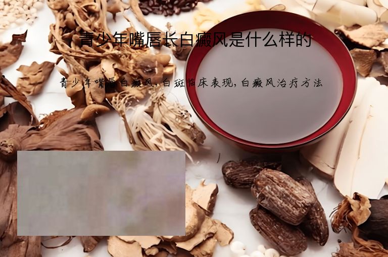 青少年嘴唇长白癜风是什么样的”