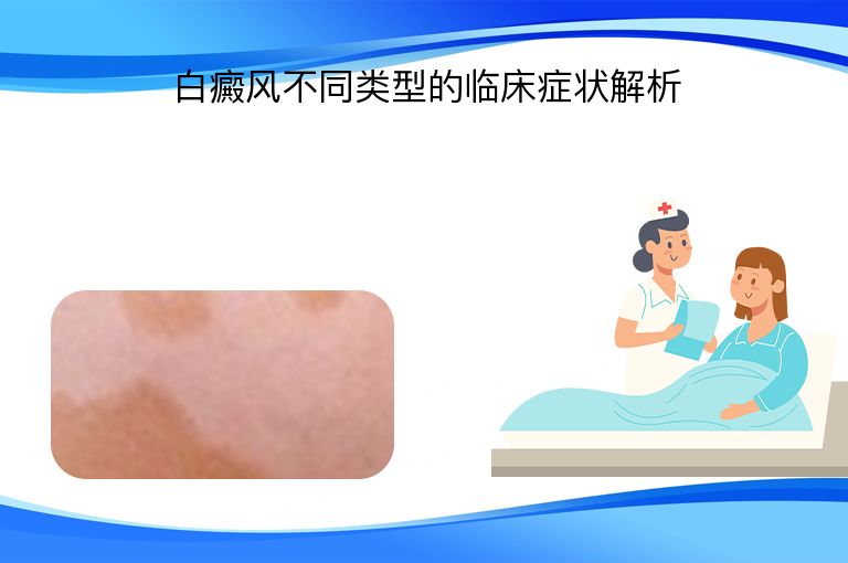 https://www.bdfsjzyy.com/d/file/p/350e4d57138f115ee0da1c7f8e24a3b4.jpeg