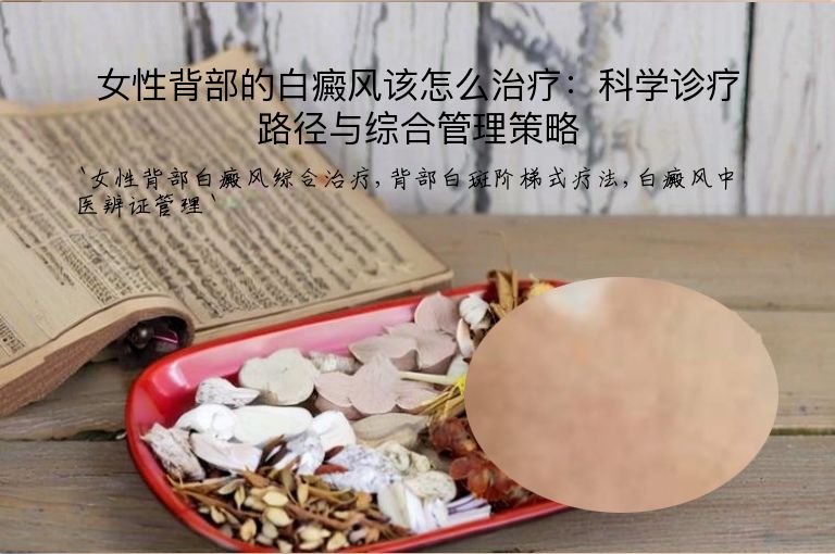女性背部的白癜风该怎么治疗:科学诊疗路径与综合管理策略
