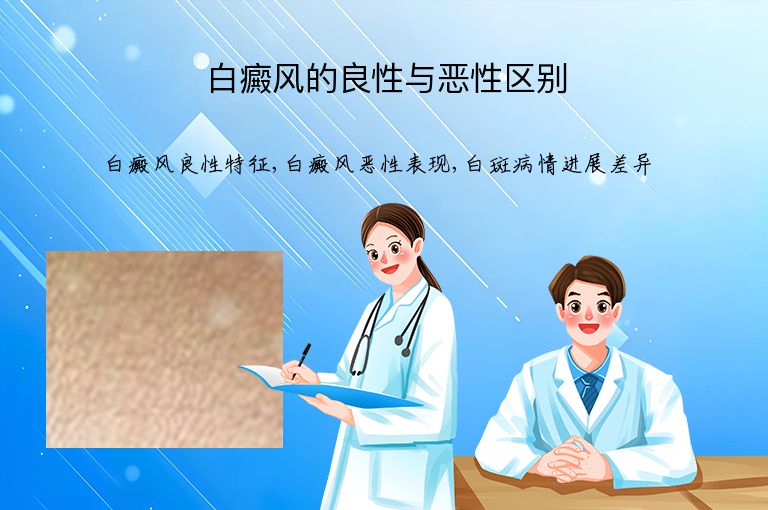 白癜风的良性与恶性区别”