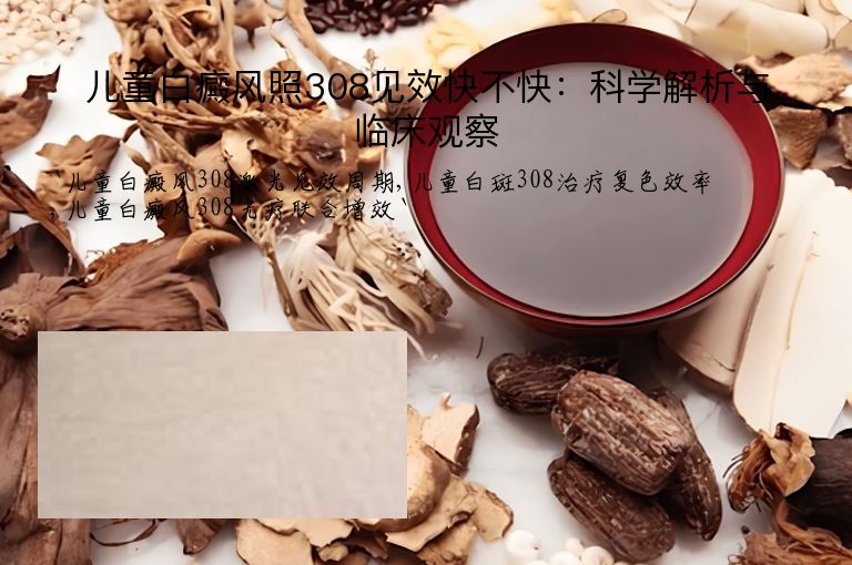 儿童白癜风照308见效快不快:科学解析与临床观察
