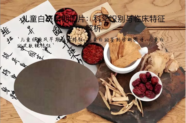 儿童白斑早期图片:科学识别与临床特征解析