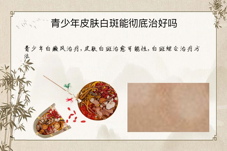 青少年皮肤白斑能彻底治好吗”