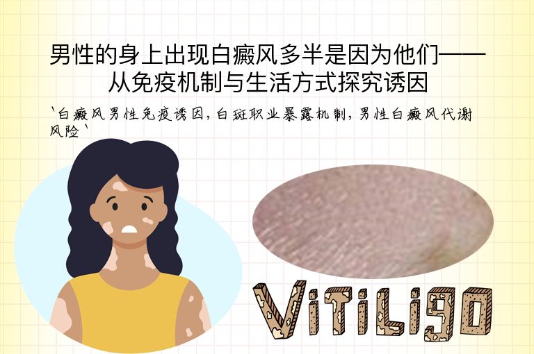 男性的身上出现白癜风多半是因为他们——从免疫机制与生活方式探究诱因