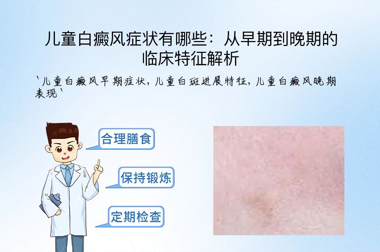 儿童白癜风症状有哪些：从早期到晚期的临床特征解析