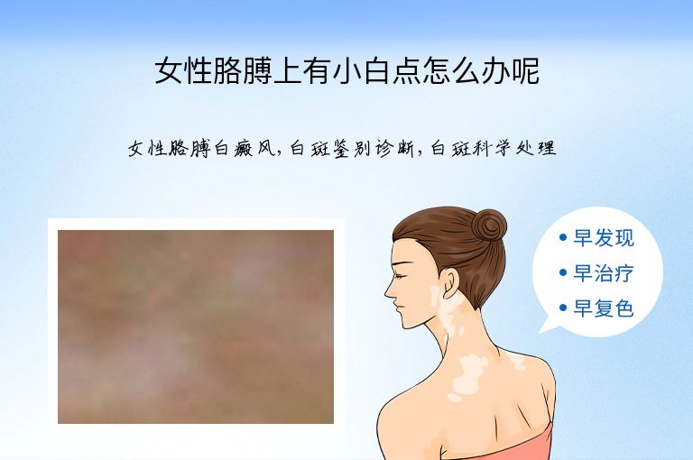 女性胳膊上有小白点怎么办呢”
